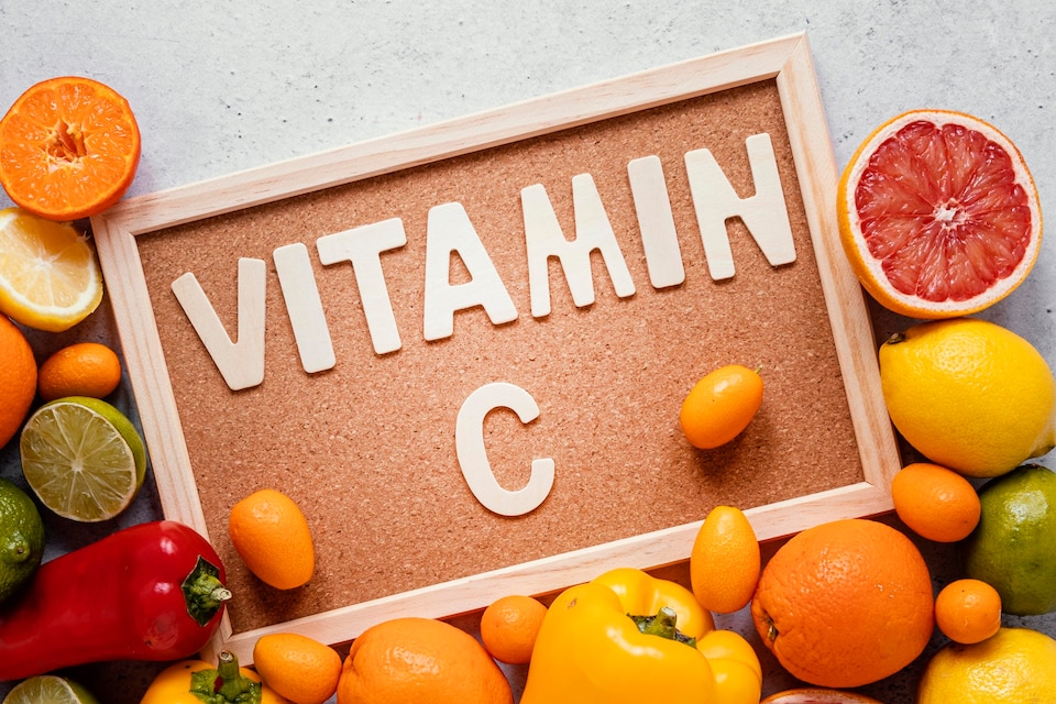 Top 5 Richest Foods in Vitamin C